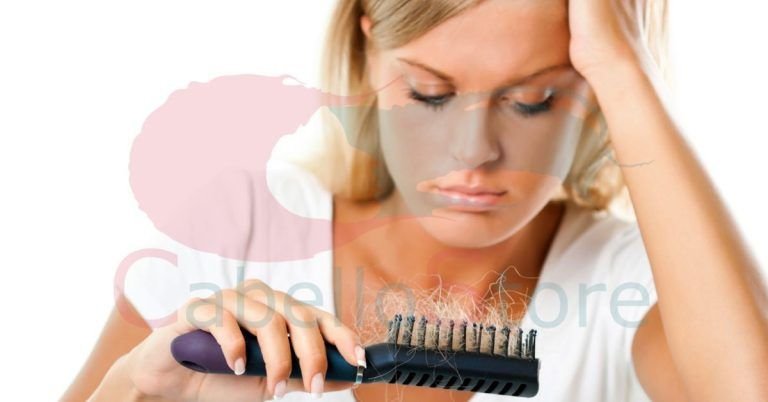 Sobre la caída del cabello